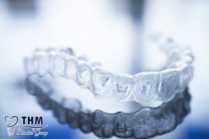 Bảng giá 105 CHINH-NHA-BANG-PHAN-MEM-INVISALIGN