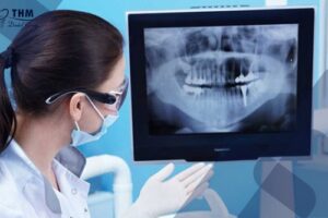 Bảng giá 97 Các bước cấy ghép Implant - X-quang răng