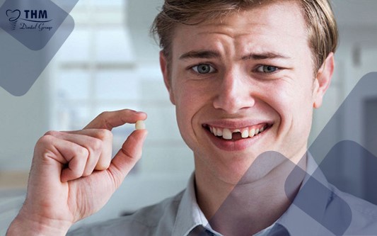 Trồng răng Implant thay cho răng gãy rụng