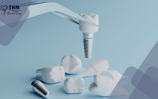 Tái tạo răng sứ trên Implant là gì? Quy trình thực hiện như thế nào?
