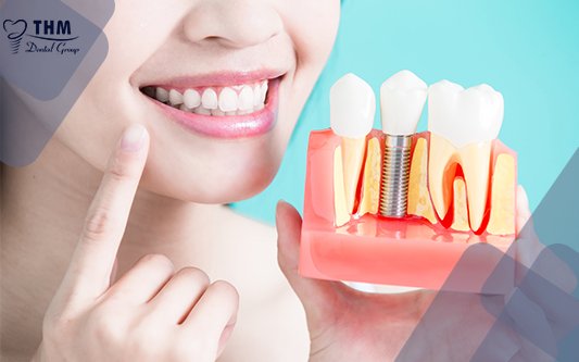 Bạn có biết! Sau khi trồng răng implant kiêng ăn gì?