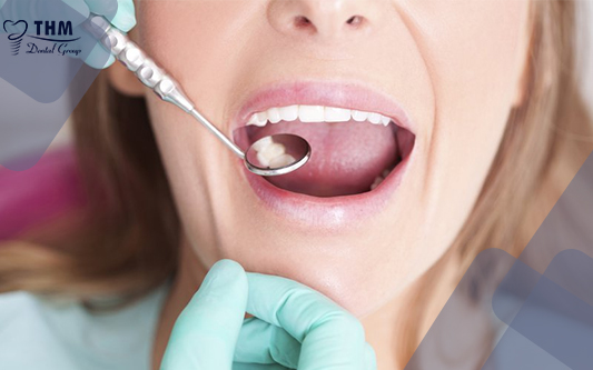 [ 2021] Trồng răng implant có niềng được không? 
