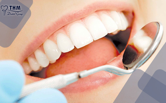 Bọc răng sứ thẩm mỹ là nhu cầu phổ biến hiện nay