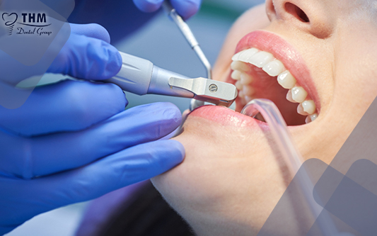 Bọc răng sứ có ảnh hưởng gì không?