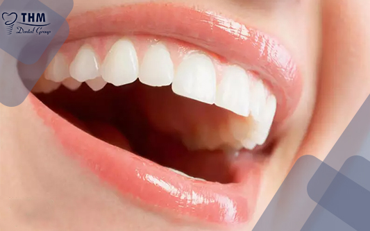 Bọc răng sứ giúp bạn tự tin hơn