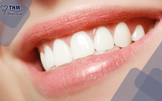 Hình 1. Bọc răng sứ giúp hàm răng của bạn trở nên thẳng đều đẹp mắt hơn