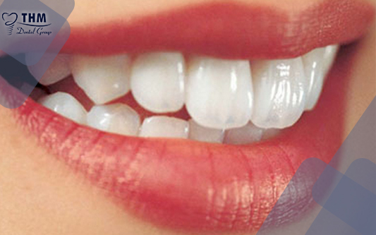 Bọc răng sứ cho răng hô giúp hàm răng sáng bóng và tiết kiệm thời gian