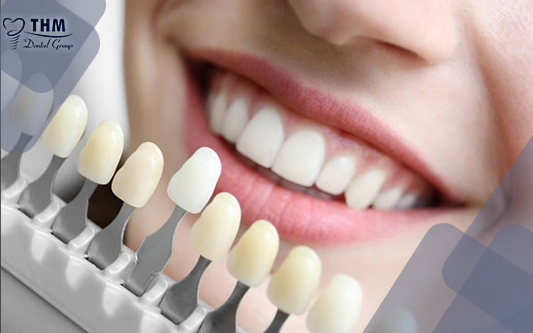 Bọc răng sứ - là giải pháp nha khoa được ưa chuộng giúp phục hình lại thẩm mỹ cho hàm răng