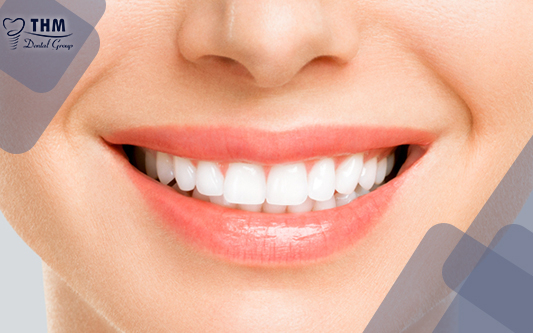 Dán răng sứ mang lại hiệu quả thẩm mỹ cao