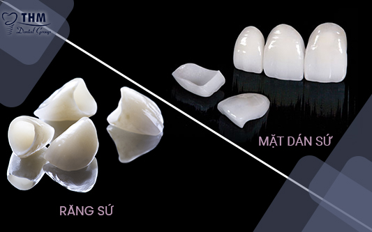 Điểm khác nhau giữa răng sứ và mặt dán sứ