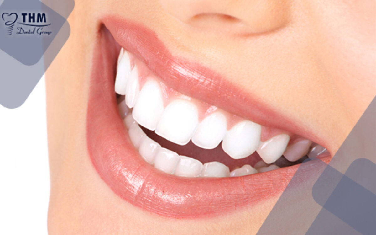 Nha khoa Đức Nguyên   10 𝑫𝒂𝒏𝒈 𝒓𝒂𝒏𝒈 𝐒𝐮 𝒌𝒉𝒂𝒄𝒉  𝒉𝒂𝒏𝒈 𝒍𝒖𝒂 𝒄𝒉𝒐𝒏 𝒏𝒉𝒊𝒆𝒖 𝒏𝒉𝒂𝒕  Ngoài chất liệu  răngsứ thì hình dáng răng cũng là vấn đề mà khách hàng