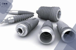 Bảng giá 100 Implant Hàn Quốc