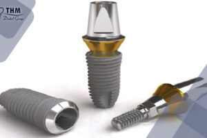 Bảng giá 101 Implant Mỹ
