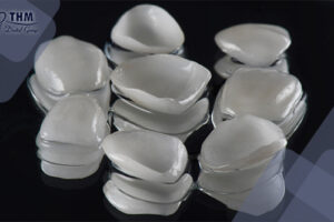Bảng giá 86 mat-dan-su-veneer-gia-bao-nhieu