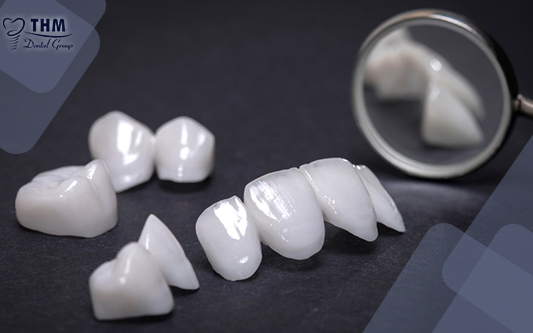 Mỗi loại răng sứ lại có thời gian bảo hành khác nhau