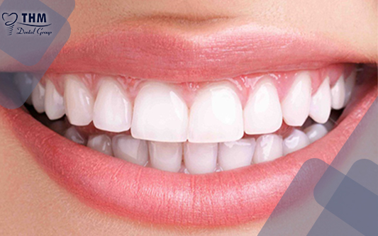 Nha Khoa Thế Hệ Mới sẽ giúp bạn có hàm răng trắng sáng