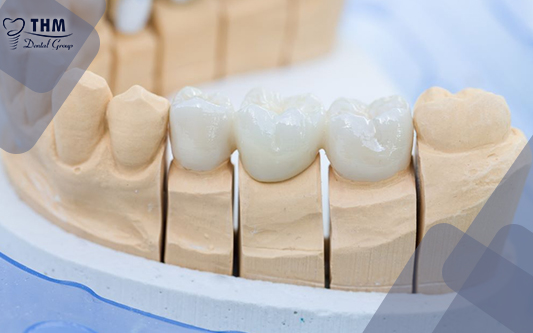 Phục hình răng bằng răng sứ titan là phương pháp phổ biến được sử dụng nhiều hiện nay.