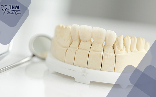 Phục hình răng sứ chính là phương pháp nha khoa được nhiều người lựa chọ