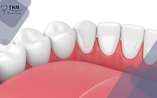 Quy trình bọc răng sứ đúng sẽ giúp răng bạn đều và đẹp hơn bao giờ hết