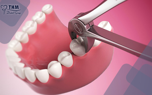 Quy trình tháo răng sứ không đau được tiến hành như thế nào?