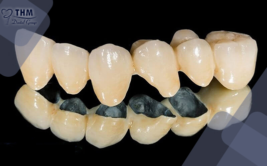 Răng sứ cao cấp Titan