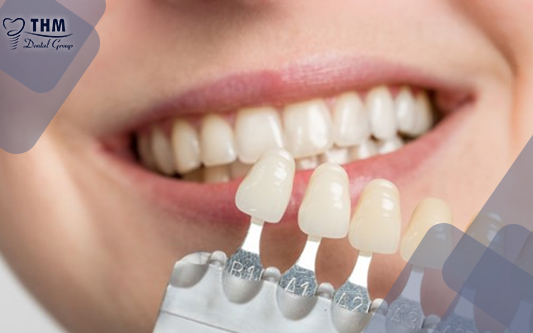 Răng sứ có màu trắng ngà giống hệt như răng thật 
