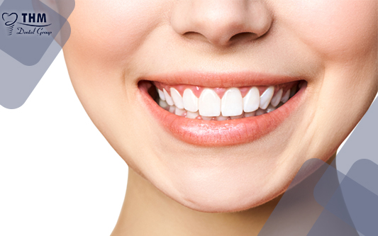 Răng sứ không thể thực hiện tẩy trắng răng