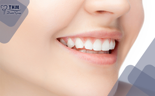 Răng sứ thẩm mỹ giúp bạn tự tin hơn với nụ cười tỏa nắng