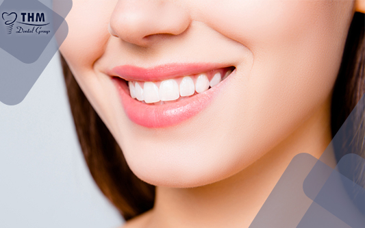 Răng sứ thẩm mỹ giúp răng trắng sáng, đẹp tự nhiên