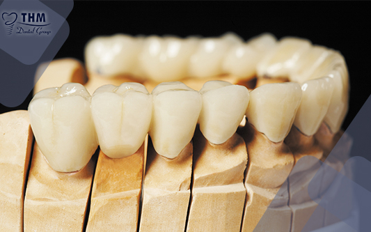 Răng sứ Titan đi kèm với chất lượng cao sẽ đem lại giá trị thẩm mỹ tuyệt vời cho hàm răng của bạn.