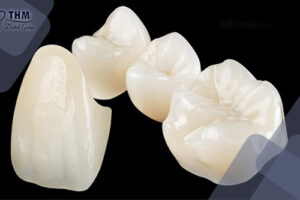 Bảng giá 84 Răng sứ zirconia