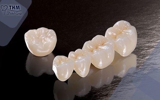 Răng sứ toàn sứ là giải pháp phù hợp cho vấn đề răng bị đen viền nướu