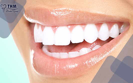 Sử dụng dịch vụ bọc răng sứ tại nha khoa Thế Hệ Mới là sự đảm bảo của uy tín và chất lượng
