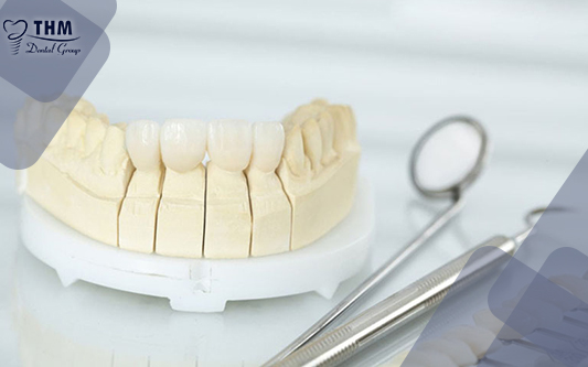 Tháo răng sứ không đau sẽ không còn khó khăn tại Nha khoa thế hệ mới
