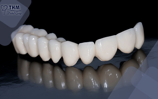 Tìm hiểu về các loại răng sứ phổ biến hiện nay