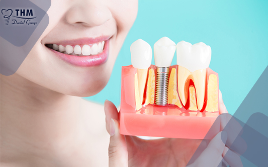 Trồng răng Implant giúp nụ cười thêm phần tự tin