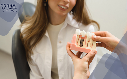 Trồng răng implant ở Nha khoa Thế Hệ Mới