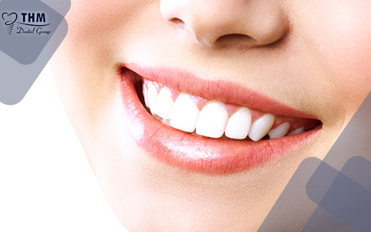 Trồng răng sứ giúp răng trắng sáng, khỏe đẹp tự nhiên