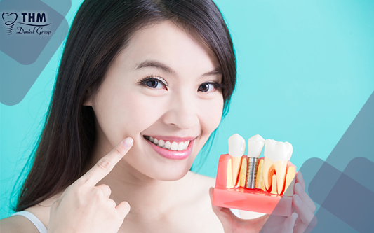 Trồng răng sứ implant giúp cải thiện hàm răng khỏe, đẹp tự nhiên