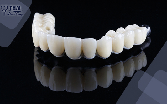 Trồng răng sứ nguyên hàm thay thế những hàm răng khuyết điểm