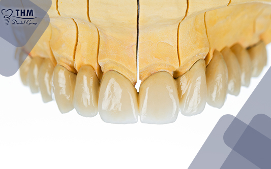 Trồng răng sứ titan là một trong những dịch vụ được thực hiện nhiều nhất trong lĩnh vực nha khoa