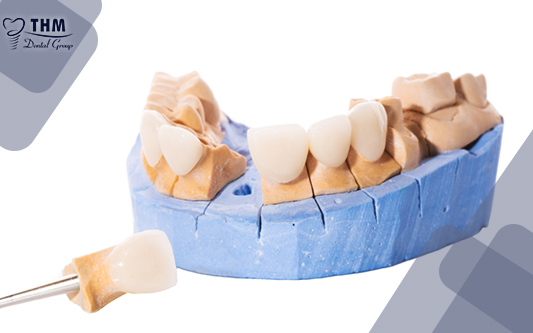 Trồng răng sứ chất lượng với mức giá ưu đãi nhất