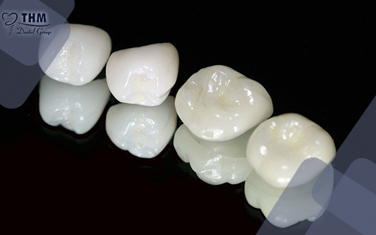 Ưu điểm và nhược điểm của răng sứ zirconia