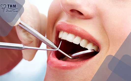Xu hướng làm đẹp với dịch vụ trồng răng sứ thẩm mỹ ngày càng được nhiều người ưa chuộng