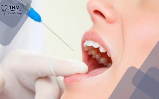Xử lý tình trạng bọc răng sứ bị nhức phải chính xác và làm theo hướng dẫn của bác sĩ nha khoa